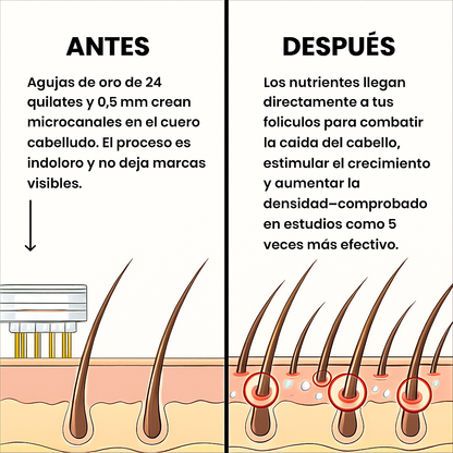 Sistema de regeneración capilar AlphaInfuse™