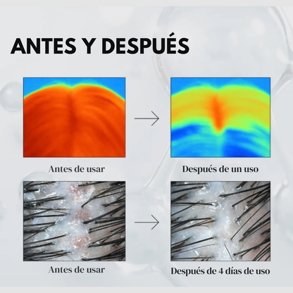 Ampolla Capilar PDRN Reedle Shot